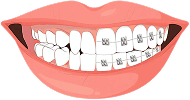 orthodontics