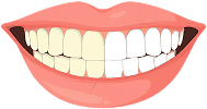 tooth-whitening